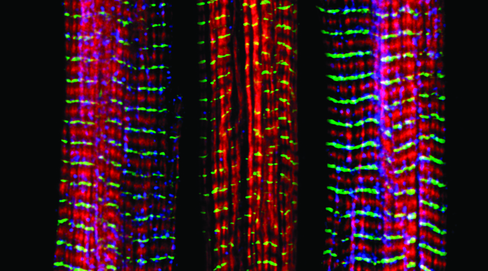 Three muscle fibers; the middle has a defect found in some neuromuscular diseases Of the three muscle fibers shown here, the one on the right and the one on the left are normal. The middle fiber is deficient a large protein called nebulin (blue). Nebulin plays a number of roles in the structure and function of muscles, and its absence is associated with certain neuromuscular disorders. Credit: Christopher Pappas and Carol Gregorio, University of Arizona via Flickr.