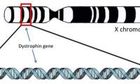 Diagram of chromosome showing Dystrophin gene